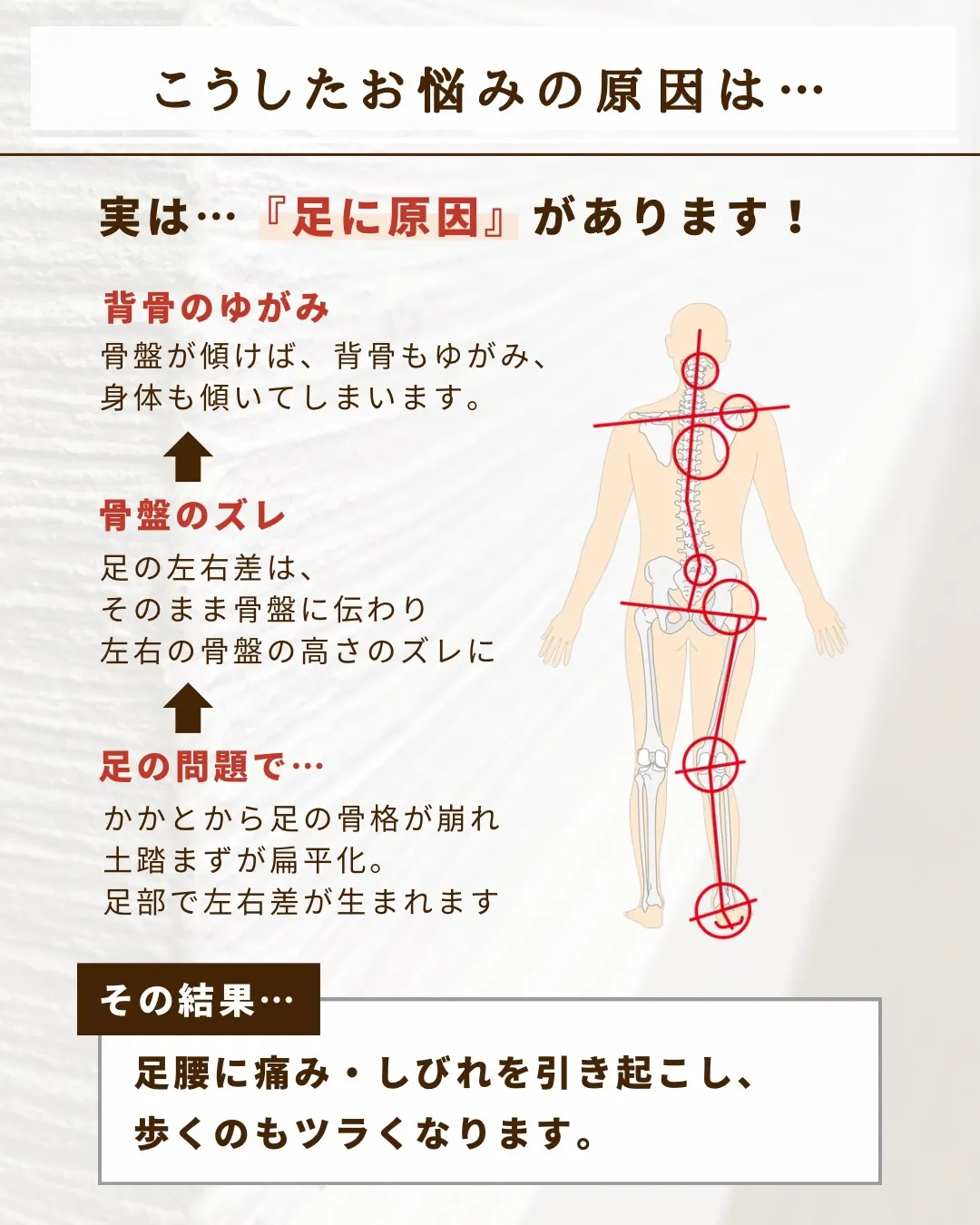 腰痛／足の痛み・しびれ／10分以上歩けない方へ