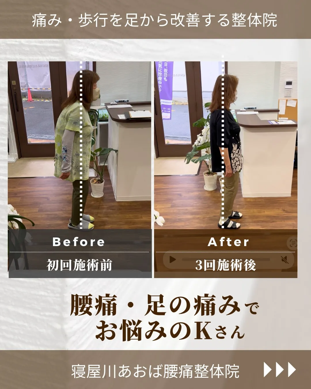 腰痛・足の痛みでお悩み/70代女性