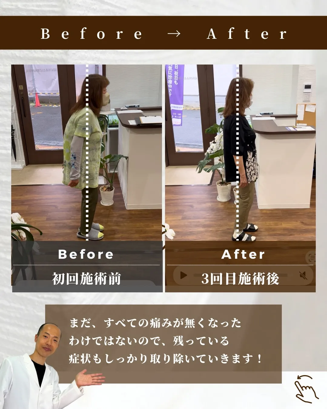 腰痛・足の痛みでお悩み/70代女性