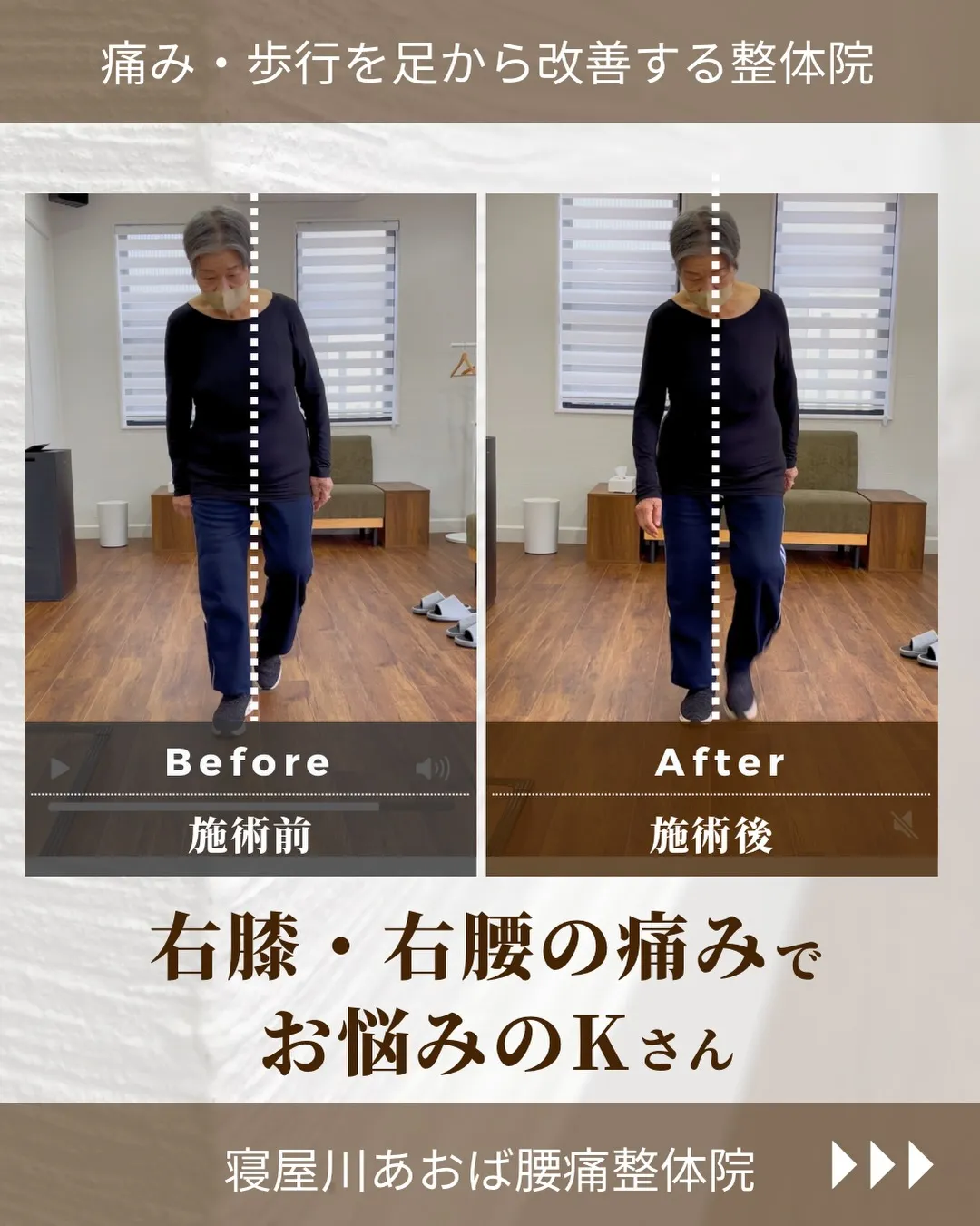 右膝、右腰の痛みでお悩みのKさん/70代女性