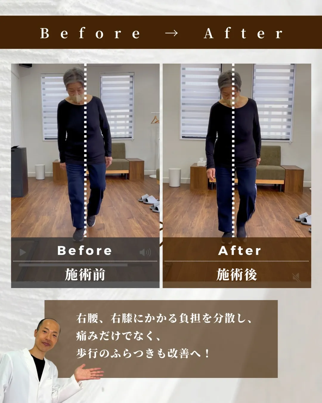 右膝、右腰の痛みでお悩みのKさん/70代女性